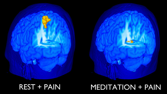 meditationvpain